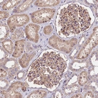 Immunohistochemical staining of human kidney shows moderate cytoplasmic/membranous positivity in cells in tubules and cells in glomeruli.