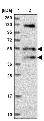 Lane 1: Marker [kDa] 250, 130, 95, 72, 55, 36, 28, 17, 10_br/_Lane 2: Human cell line RT-4