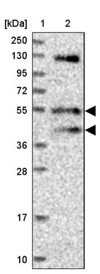Lane 1: Marker [kDa] 250, 130, 95, 72, 55, 36, 28, 17, 10_br/_Lane 2: Human cell line RT-4
