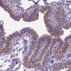 Anti-IFT140 Antibody