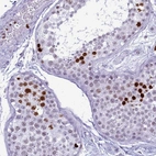 Immunohistochemical staining of human testis shows moderate to strong nuclear positivity in cells in seminiferous ducts.