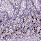 Immunohistochemical staining of human small intestine shows moderate to strong nuclear positivity in glandular cells.