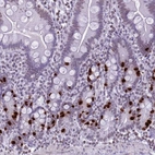 Immunohistochemical staining of human small intestine shows moderate to strong nuclear positivity in glandular cells.
