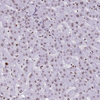 Immunohistochemical staining of human liver shows very weak nuclear positivity in hepatocytes.