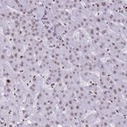 Immunohistochemical staining of human liver shows very weak nuclear positivity in hepatocytes.