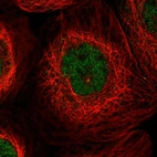 Immunofluorescent staining of human cell line A-431 shows localization to nucleoplasm.