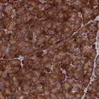 Anti-SH3D21 Antibody