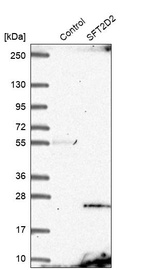 Western blot analysis in control (vector only transfected HEK293T lysate) and SFT2D2 over-expression lysate (Co-expressed with a C-terminal myc-DDK tag (~3.1 kDa) in mammalian HEK293T cells, LY404531).