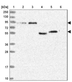 Lane 1: Marker [kDa] 250, 130, 95, 72, 55, 36, 28, 17, 10_br/_Lane 2: Human cell line RT-4_br/_Lane 3: Human cell line U-251MG sp_br/_Lane 4: Human plasma (IgG/HSA depleted)_br/_Lane 5: Human liver tissue_br/_Lane 6: Human tonsil tissue