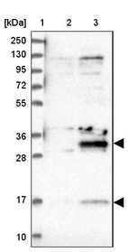 Lane 1: Marker [kDa] 250, 130, 95, 72, 55, 36, 28, 17, 10_br/_Lane 2: Human cell line RT-4_br/_Lane 3: Human cell line U-251MG sp