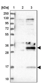 Lane 1: Marker [kDa] 250, 130, 95, 72, 55, 36, 28, 17, 10_br/_Lane 2: Human cell line RT-4_br/_Lane 3: Human cell line U-251MG sp