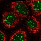 Immunofluorescent staining of human cell line A-431 shows localization to nucleus, nucleoli & vesicles.