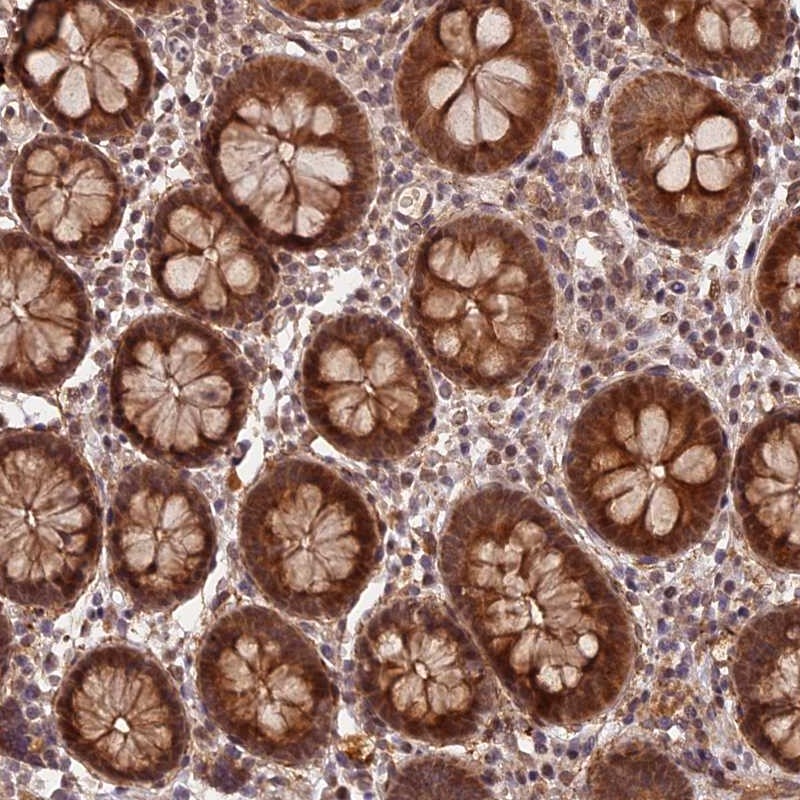 Anti-ZNF480 Antibody