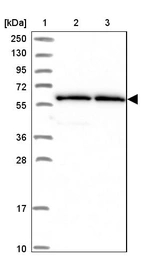 Lane 1: Marker [kDa] 250, 130, 95, 72, 55, 36, 28, 17, 10_br/_Lane 2: Human cell line RT-4_br/_Lane 3: Human cell line U-251MG sp