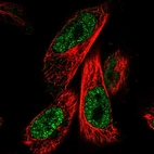 Immunofluorescent staining of human cell line U-251 MG shows localization to nucleoplasm.