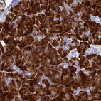 Anti-AQP12A Antibody