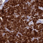 Immunohistochemical staining of human pancreas shows strong cytoplasmic positivity in exocrine glandular cells.