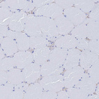 Anti-AQP12A Antibody