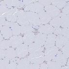 Immunohistochemical staining of human skeletal muscle shows no positivity in myocytes as expected.