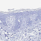 Anti-AQP12A Antibody