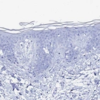 Immunohistochemical staining of human skin shows no positivity in squamous epithelial cells as expected.