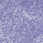 Anti-AQP12A Antibody