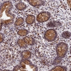 Anti-PYGO1 Antibody