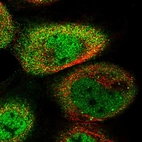 Immunofluorescent staining of human cell line A-431 shows localization to nucleoplasm & cytosol.