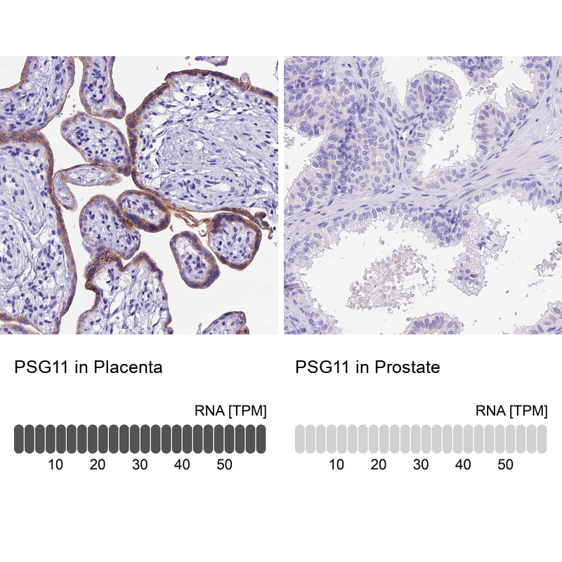 Anti-PSG11 Antibody
