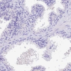 Immunohistochemical staining of human prostate shows low expression as expected.