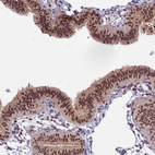 Anti-TADA3 Antibody