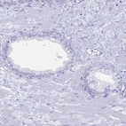 Immunohistochemical staining of human prostate shows no positivity in glandular cells as expected.