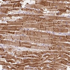 Immunohistochemical staining of human heart muscle shows strong cytoplasmic positivity in cardiomyocytes.