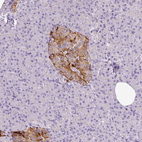 Anti-PAM Antibody