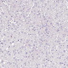 Immunohistochemical staining of human liver shows no positivity in hepatocytes as expected.