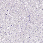 Anti-PAM Antibody