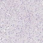 Immunohistochemical staining of human liver shows no positivity in hepatocytes as expected.