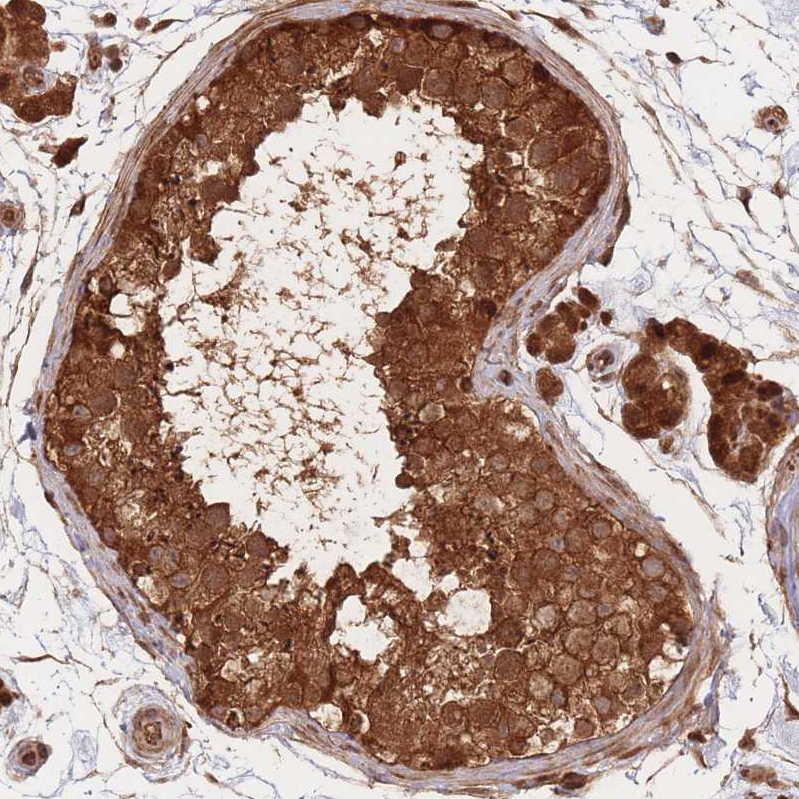 Anti-PODXL2 Antibody