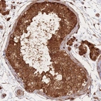 Anti-PODXL2 Antibody
