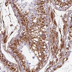 Anti-PPFIA1 Antibody