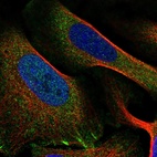 Immunofluorescent staining of human cell line U-2 OS shows localization to cytosol & focal adhesion sites.