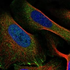 Immunofluorescent staining of human cell line U-2 OS shows localization to cytosol & focal adhesion sites.