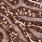 Immunohistochemical staining of human small intestine shows high expression.