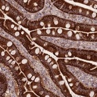 Immunohistochemical staining of human small intestine shows high expression.