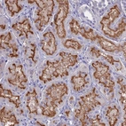 Anti-SLC2A6 Antibody