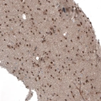 Immunohistochemical staining of human cerebral cortex shows moderate to strong membranous positivity in neurons.