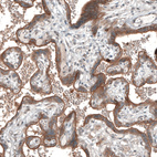 Immunohistochemical staining of human placenta shows moderate to strong membranous positivity in trophoblastic cells.