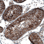 Immunohistochemical staining of human testis shows moderate to strong membranous positivity in cells in seminiferous ducts.