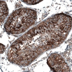 Immunohistochemical staining of human testis shows moderate to strong membranous positivity in cells in seminiferous ducts.