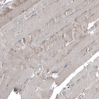 Immunohistochemical staining of human skeletal muscle shows no positivity in myocytes as expected.